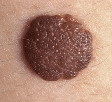 Moles