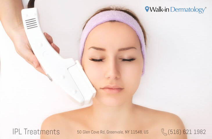 Photofacial