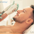 IPL treatment male patient