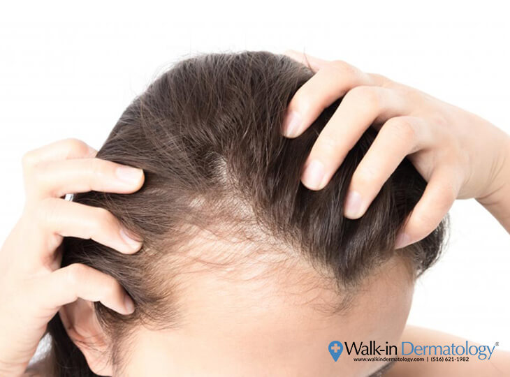 Covid-19 and Hair Loss