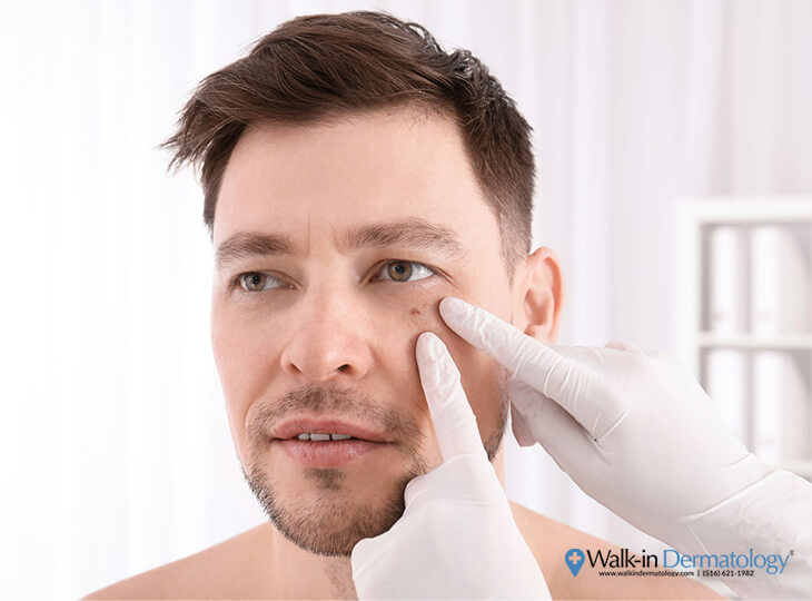 Mohs Surgery | Dermatology