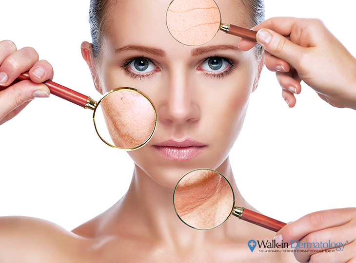 Signs of skin aging