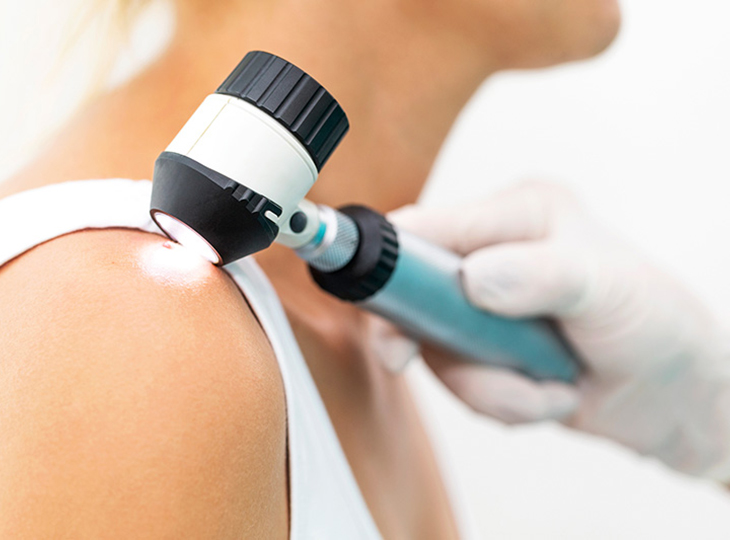 Dermatologist using a dermatoscope to check for skin cancer on a patient